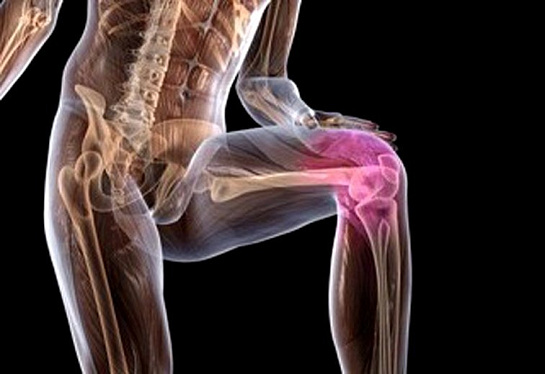 Если болят суставы... Излечим ли остеоартроз?