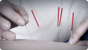 REHABILITATION MEDICINE DEPARTMENT REHABILITATION MEDICINE DEPARTMENT