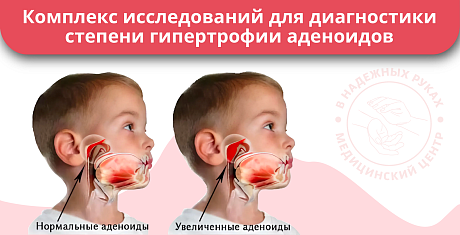 Комплекс исследований для диагностики степени гипертрофии аденоидов Комплекс исследований для диагностики степени гипертрофии аденоидов